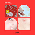 Trouble Clear Needle Patch 9pcs